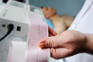 Electrocardiogram, ECG in hand