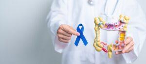 cancerducolon